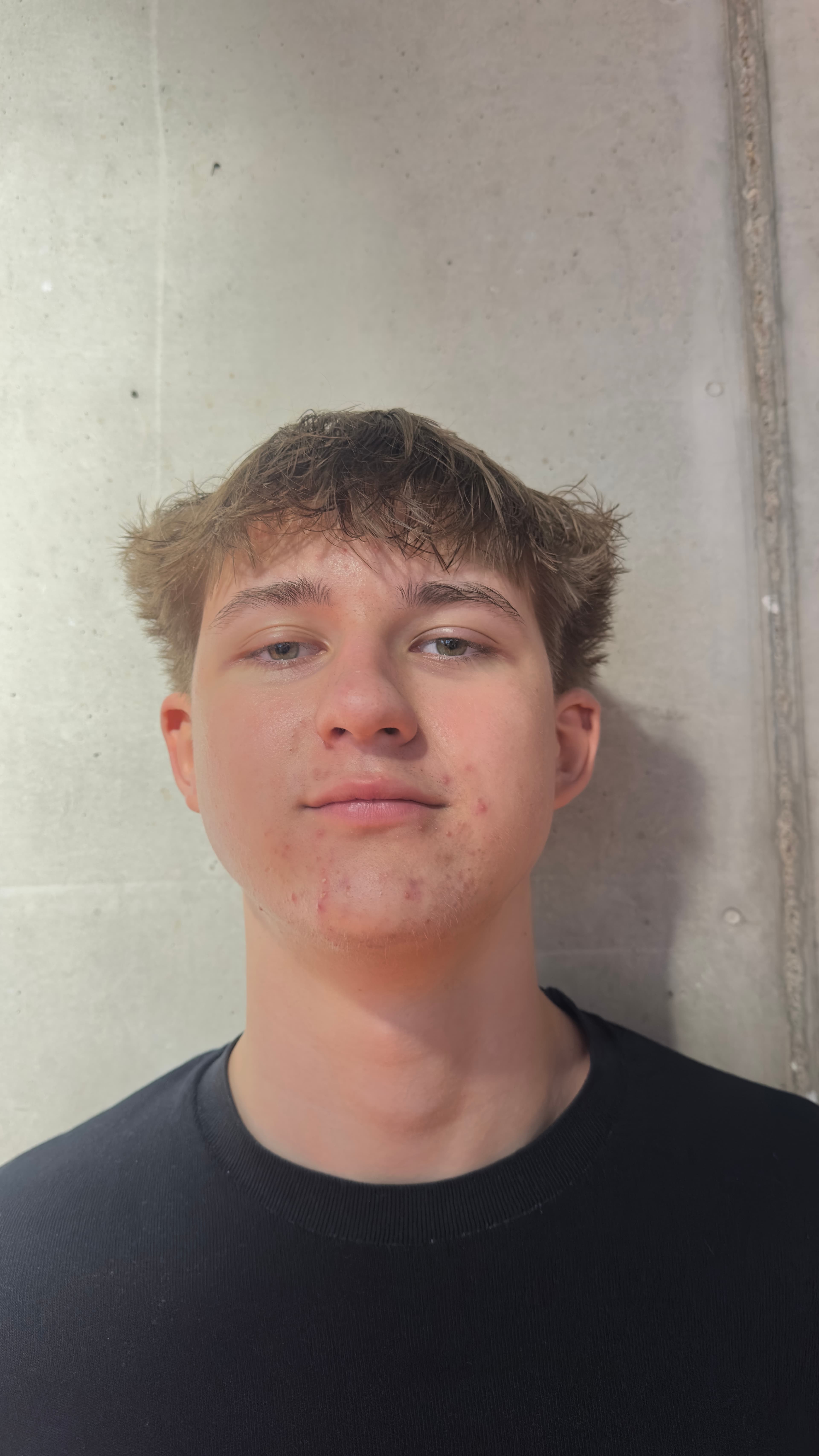 Young man with messy brown hair and acne wearing a black t-shirt against concrete.